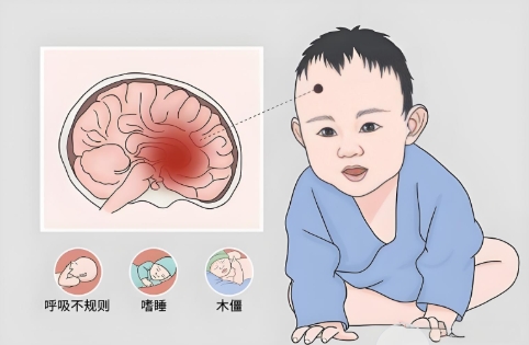 小儿脑神经疾病